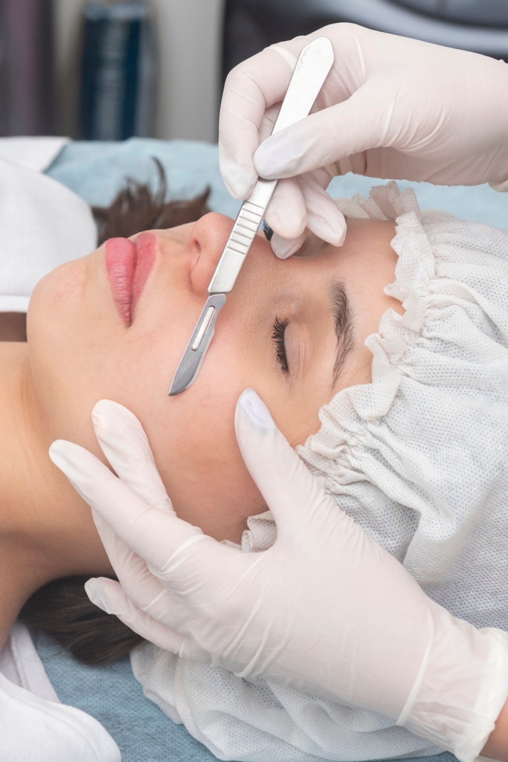 removing dead skin cells and peach fuzz with med spa dermaplaning - U R Royalty Med Spa - Cypress, Texas